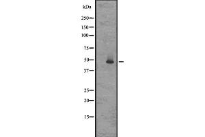 Western blot analysis of GPR83/GPR72 expression in Rat brain lysates in RIPA buffer ;developed using the ECL technique;,The lane on the left is treated with the antigen-specific peptide. (GPR83 anticorps  (N-Term))