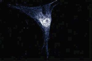 Immunofluorescence staining of human fibroblasts.