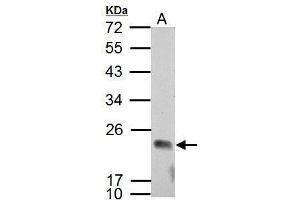 WB Image Sample (30 ug of whole cell lysate) A: NCI-H929 12% SDS PAGE antibody diluted at 1:2000 (APOBEC3C anticorps  (Center))
