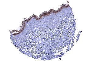 A strong KLK7 staining in the stratum granulosum and the keratinizing superficial layer of the skin (Kallikrein 7 anticorps)