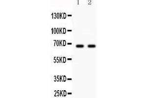 Anti- Parkin Picoband antibody, Western blotting All lanes: Anti Parkin  at 0. (Parkin anticorps  (AA 23-416))