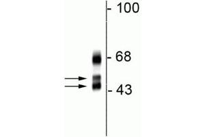 Western blot of rat cortical lysate showing specific immunolabeling of the ~46/48 kDa FOX1 protein.