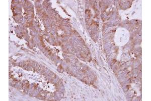 anti-Huntingtin Interacting Protein 1 Related (HIP1R) (N-Term) antibody