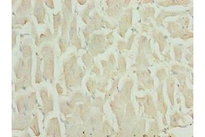 Immunohistochemistry of paraffin-embedded human heart tissue using ABIN7155873 at dilution of 1:100 (HOPX anticorps  (AA 1-73))