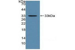 Detection of Recombinant MHCC, Human using Polyclonal Antibody to Major Histocompatibility Complex Class I C (MHCC) (HLA-C anticorps  (AA 48-305))