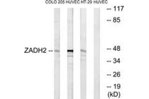 Western blot analysis of extracts from HuvEc/HT-29/COLO cells, using ZADH2 Antibody. (ZADH2 anticorps  (AA 191-240))