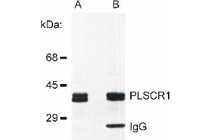 Detection of PLSCR1 in rat basophilic leukemia (RBL) cell line lysate (A) and in PLSCR1 immunoprecipitate from RBL lysate (B). (PLSCR1 anticorps)