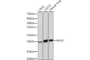 Western blot analysis of extracts of various cell lines, using MYL9 Rabbit mAb (ABIN7268755) at 1:1000 dilution. (MYL9 anticorps)