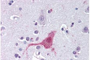 Anti-EDNRB antibody  ABIN1048558 IHC staining of human brain, cortex. (EDNRB anticorps  (N-Term))