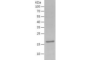 Western Blotting (WB) image for Family with Sequence Similarity 20, Member C (FAM20C) (AA 102-244) protein (His tag) (ABIN7122879)