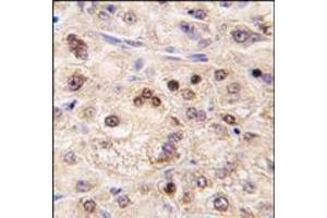 anti-Zinc Finger and BTB Domain Containing 7B (ZBTB7B) (Middle Region) antibody