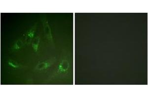 Immunofluorescence analysis of HeLa cells, using CSFR (Ab-561) Antibody. (CSF1R anticorps  (AA 531-580))
