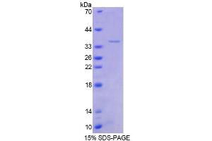 SDS-PAGE analysis of Human TSC22 Protein. (TSC22D1 Protéine)