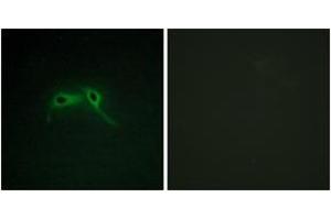 Immunofluorescence analysis of HepG2 cells, using NF1 Antibody.