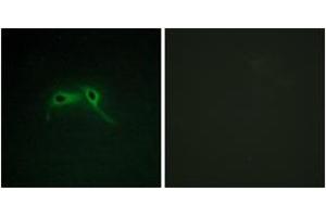 Immunofluorescence analysis of HepG2 cells, using NF1 Antibody. (Neurofibromin 1 anticorps  (AA 1551-1600))