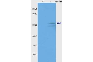Lane 1: human colon carcinoma lysates Lane 2: mouse brain lysates probed with Anti GABRG2/GABA A Receptor gamma 2 Polyclonal Antibody, Unconjugated (ABIN754003) at 1:200 in 4 °C.