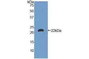 Western blot analysis of recombinant Mouse LAMa1. (Laminin alpha 1 anticorps  (AA 2640-2773))
