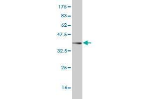Western Blot detection against Immunogen (37. (AKAP13 anticorps  (AA 1-110))