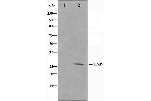 Western blot analysis on NIH-3T3 cell lysate using TIMP4 Antibody,The lane on the left is treated with the antigen-specific peptide. (TIMP4 anticorps  (C-Term))