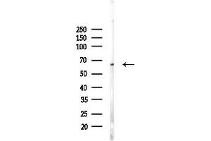 Western blot analysis of lysates from PC12 cells(LPS, 4h treatment), using MPP5 Antibody at 1/1000 dilution.