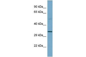Host:  Rabbit  Target Name:  SGCB  Sample Type:  Fetal Small Intestine lysates  Antibody Dilution:  1. (SGCB anticorps  (Middle Region))
