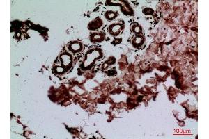 Immunohistochemistry (IHC) analysis of paraffin-embedded Human Skin, antibody was diluted at 1:100. (CEACAM1/5 anticorps  (N-Term))