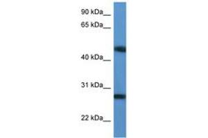 Image no. 1 for anti-TM2 Domain Containing 2 (TM2D2) (AA 97-146) antibody (ABIN6746862) (TM2D2 anticorps  (AA 97-146))
