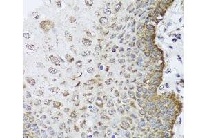 Immunohistochemistry of paraffin-embedded Human esophagus using FANCL Polyclonal Antibody at dilution of 1:100 (40x lens).