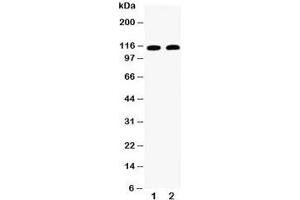 Western blot testing of Desmoglein 3 antibody and Lane 1:  A431;  2: CEM