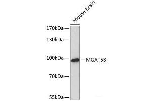 Western blot analysis of extracts of Mouse brain using MGAT5B Polyclonal Antibody at dilution of 1:3000. (MGAT5B anticorps)