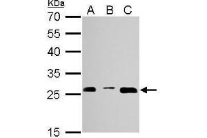 WB Image Proteasome 20S alpha 3 antibody detects PSMA3 protein by Western blot analysis. (PSMA3 anticorps  (Center))