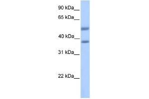 ST6GALNAC2 antibody used at 1 ug/ml to detect target protein.