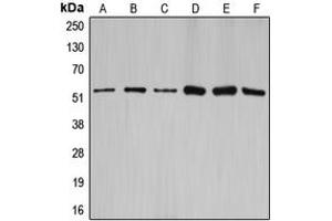 Western blot analysis of Cyclin A1/2 expression in HEK293T (A), NIH3T3 (B), rat brain (C), SW626 (D), SKOV3 (E), A2780 (F) whole cell lysates. (Cyclin-A1-2 anticorps  (Center))