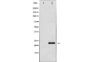 Western blot analysis SOCS2 using COS7 whole cell lysates