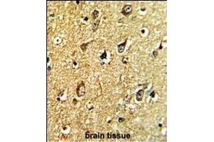 Formalin-fixed and paraffin-embedded human brain tissue with TH Antibody (C-term), which was peroxidase-conjugated to the secondary antibody, followed by DAB staining. (TH anticorps  (C-Term))
