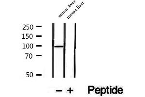 Western blot analysis of extracts of mouse liver tissue, using STT3B antibody.