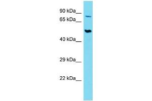 Host:  Rabbit  Target Name:  SLC44A2  Sample Type:  Thymus Tumor lysates  Antibody Dilution:  1. (SLC44A2 anticorps  (Middle Region))