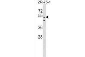 Western Blotting (WB) image for anti-PDZ Domain Containing 3 (PDZD3) antibody (ABIN2999605) (PDZD3 anticorps)