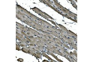 IHC analysis of NDUFB5 using anti-NDUFB5 antibody (ABIN7601297).