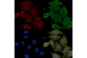 ABIN6258953 and ABIN6276209 staining Hela cells(45 min of heat-shock) by IF/ICC. (QRFPR anticorps  (Internal Region))