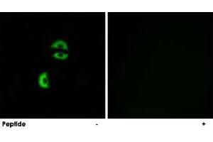 Immunofluorescence analysis of A-549 cells, using LDLRAD3 polyclonal antibody . (LDLRAD3 anticorps)