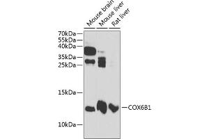 Western blot analysis of extracts of various cell lines, using COX6B1 antibody (ABIN6131579, ABIN6138917, ABIN6138918 and ABIN6216044) at 1:3000 dilution. (COX6B1 anticorps  (AA 1-86))