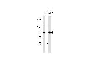 Western blot analysis of lysates from 293T, A431 cell line (from left to right), using IL4R Antibody (C-term) (ABIN1944783 and ABIN2838524).