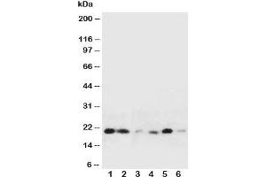 Western blot testing of HSPB2 antibody and Lane 1:  rat liver;  2: rat spleen;  3: human HeLa;  4: (h) COLO320;  5: (h) HT1080;  6: (h) MCF-7 cell lysate (HSPB2 anticorps  (Middle Region))