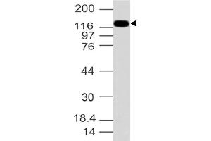 Image no. 1 for anti-Formin-Like 2 (FMNL2) (AA 1-321) antibody (ABIN5027206)