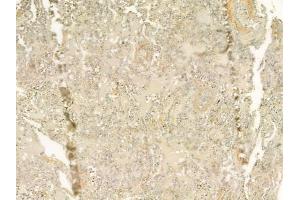 ABIN6262852 and ABIN6277515 at 1/100 staining human normal lung tissue by IHC-P.