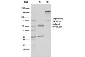 SDS-PAGE Analysis Purified FAF1 Mouse Monoclonal Antibody (CPTC-FAF1-2).