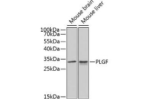 Western blot analysis of extracts of various cell lines, using PLGF antibody (ABIN3015554, ABIN3015555, ABIN3015556 and ABIN6218826) at 1:1000 dilution. (PLGF anticorps  (AA 19-170))