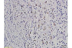Formalin-fixed and paraffin embedded rat intestine labeled with Anti HOXB8 Polyclonal Antibody, Unconjugated (ABIN717776) followed by conjugation to the secondary antibody and DAB staining (HOXB8 anticorps  (AA 11-110))