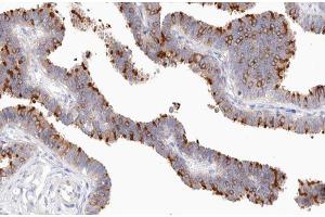 ABIN6267583 at 1/200 staining human Fallopian tube tissue sections by IHC-P. (NFKB2 anticorps  (pSer870))